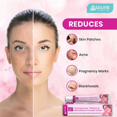 Assure Heal Glow Cream 20gm